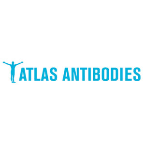 Anti-KNTC1, IgG, Rabbit, Polyclonal