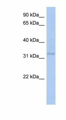 CCDC172 Антитела