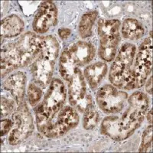 Anti-FAAH2 antibody produced in rabbit Prestige Antibodies® Powered by Atlas Antibodies, affinity isolated antibody, buffered aqueous glycerol solution
