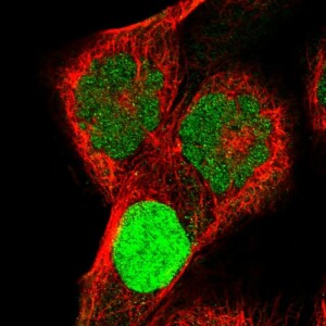 Anti-KCND1, IgG, Rabbit, Polyclonal