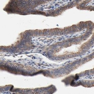 Anti-ABCD4, IgG, Rabbit, Polyclonal