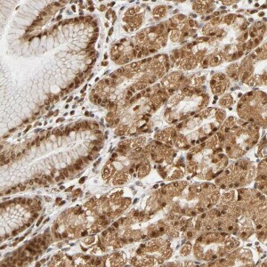Anti-RNF122, IgG, Rabbit, Polyclonal