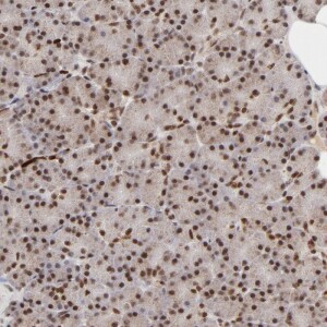 Anti-ZFX, IgG, Rabbit, Polyclonal