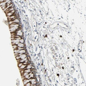 Anti-LIMCH1, IgG, Rabbit, Polyclonal