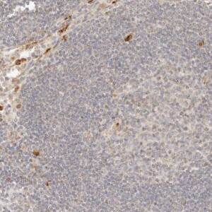Anti-PTPN22, IgG, Rabbit, Polyclonal