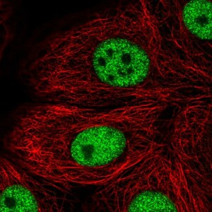 Anti-TBX2, IgG, Rabbit, Polyclonal