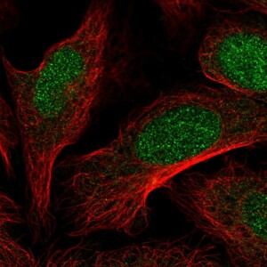 Anti-DOT1L, IgG, Rabbit, Polyclonal