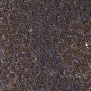 Anti-CCR6, IgG, Rabbit, Polyclonal