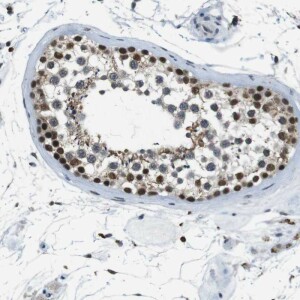 Anti-USP7, IgG, Rabbit, Polyclonal