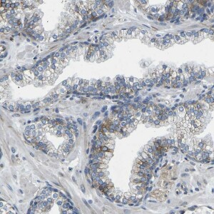 Anti-TMEFF2, IgG, Rabbit, Polyclonal