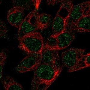 Anti-ABCG5, IgG, Rabbit, Polyclonal