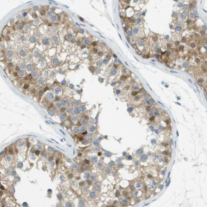 Anti-CUL9, IgG, Rabbit, Polyclonal