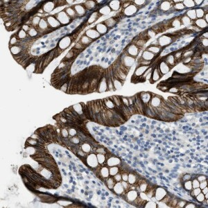 Anti-TMEM154, IgG, Rabbit, Polyclonal