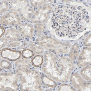 Anti-MINDY4, IgG, Rabbit, Polyclonal
