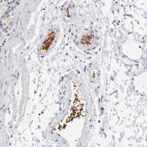 Anti-EPB41, IgG, Rabbit, Polyclonal