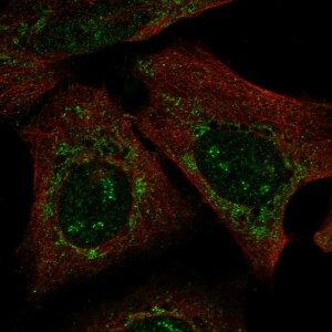 Anti-PARS2, IgG, Rabbit, Polyclonal