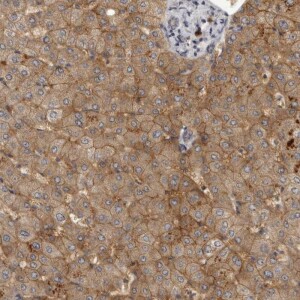 Anti-SLC22A1, IgG, Rabbit, Polyclonal