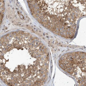 Anti-MAPKBP1, IgG, Rabbit, Polyclonal