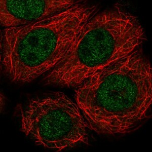 Anti-VHL, IgG, Rabbit, Polyclonal