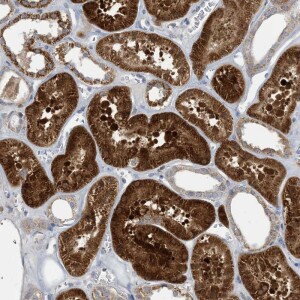 Anti-ECHDC1, IgG, Rabbit, Polyclonal