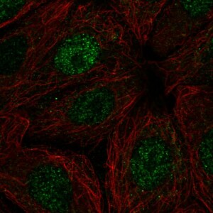 Anti-POLR2I, IgG, Rabbit, Polyclonal