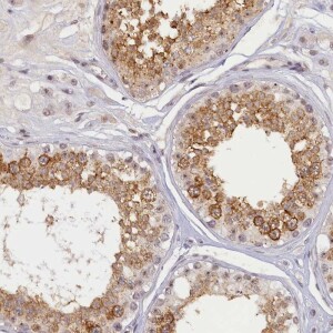Anti-SEC31B, IgG, Rabbit, Polyclonal