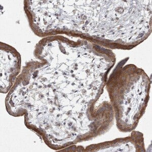Anti-WDR49, IgG, Rabbit, Polyclonal