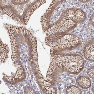 Anti-CCDC30, IgG, Rabbit, Polyclonal