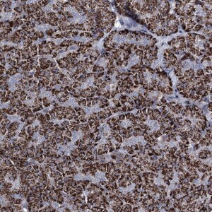 Anti-C5orf42, IgG, Rabbit, Polyclonal
