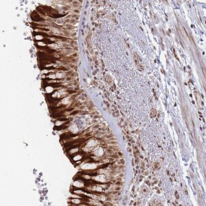 Anti-BOD1L1, IgG, Rabbit, Polyclonal