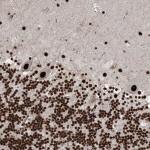 Anti-ZCCHC8, IgG, Rabbit, Polyclonal