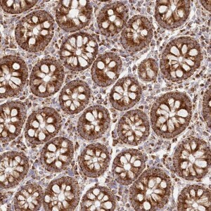 Anti-DNA2, IgG, Rabbit, Polyclonal