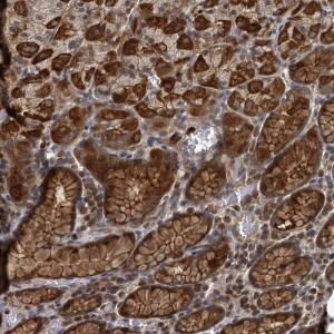 Anti-ADCY2, IgG, Rabbit, Polyclonal