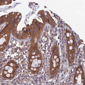 Anti-WDR24, IgG, Rabbit, Polyclonal
