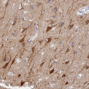 Anti-VPS33B, IgG, Rabbit, Polyclonal