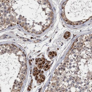 Anti-CNNM1, IgG, Rabbit, Polyclonal