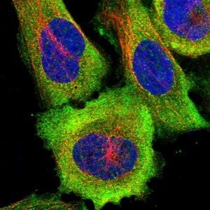 Anti-DNAAF1, IgG, Unconjugated, Rabbit, Polyclonal