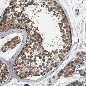 Anti-UBXN6, IgG, Rabbit, Polyclonal