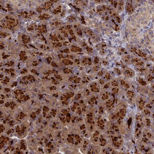Anti-AP4E1, IgG, Rabbit, Polyclonal
