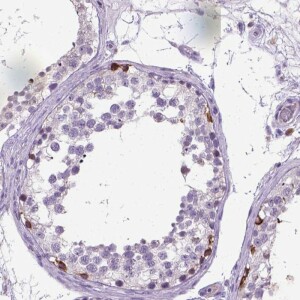 Anti-PLK4, IgG, Rabbit, Polyclonal