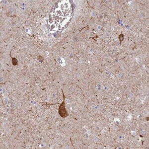 Anti-RHBDL2, IgG, Rabbit, Polyclonal