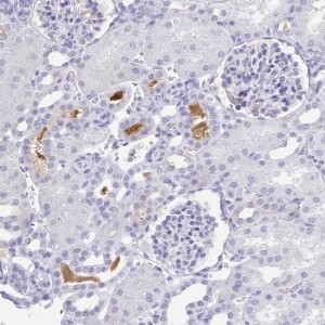 Anti-A1BG, IgG, Rabbit, Polyclonal