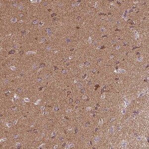 Anti-MAPK11, IgG, Rabbit, Polyclonal