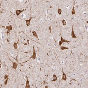 Anti-FMC1, IgG, Rabbit, Polyclonal