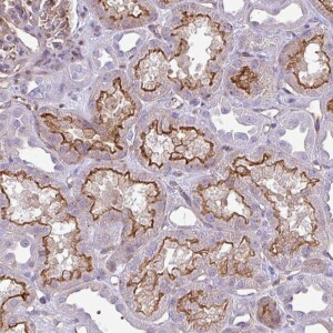 Anti-EME2, IgG, Rabbit, Polyclonal
