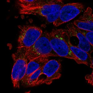 Anti-SLC29A3, IgG, Rabbit, Polyclonal