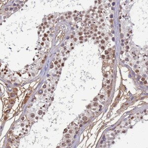 Anti-H1FNT, IgG, Rabbit, Polyclonal