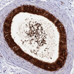 Anti-DEFB132, IgG, Rabbit, Polyclonal
