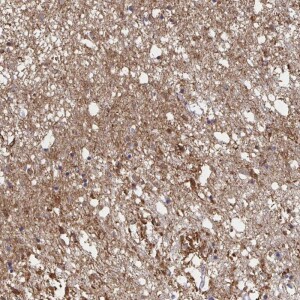 Anti-CX3CR1, IgG, Rabbit, Polyclonal