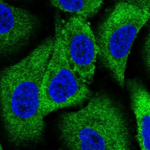 Anti-WNK1, IgG, Rabbit, Polyclonal